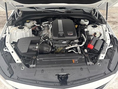 2024 Cadillac CT5 4dr Sdn Sport